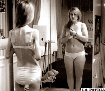 Las críticas al cuerpo pueden provocar trastornos como la anorexia
