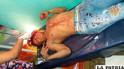 Uno de los heridos tras ataque de pandilleros en Riberalta /La Palabra del Beni