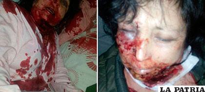 La mujer fue herida de gravedad durante la agresión del funcionario /redpaiss.com