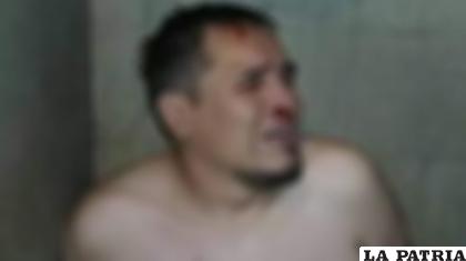 Circulan fotografías en redes sociales sobre supuesta tortura al abogado Jhasmani Torrico /RRSS