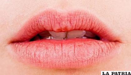 Los labios son una de las zonas más delicadas del cuerpo /estilodevida.com