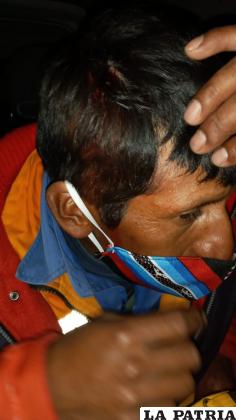 Uno de los trabajadores agredidos muestra la herida en la cabeza /LA PATRIA