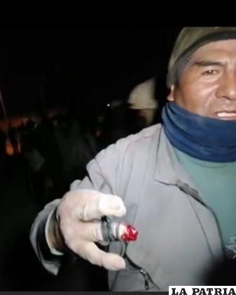 Uno de los heridos muestra que perdió parte de su dedo /LA PATRIA