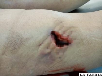 La herida en la pierna izquierda fue letal /LA PATRIA