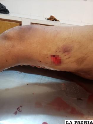 Falleció a las horas de haber sido agredido con el arma punzo cortante /LA PATRIA