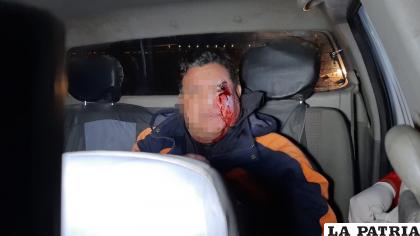 El presunto conductor ebrio tenía una herida en la ceja /LA PATRIA