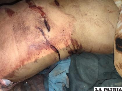 La mujer sufrió 27 puñaladas y el varón 12 /LA PATRIA