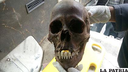 La dentadura del cráneo encontrado estaba bien conservada