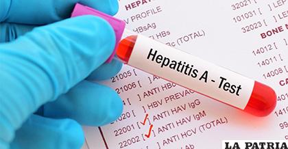 Brote de hepatitis A ha causado 221 muertos desde 2016 /SOPITAS.COM