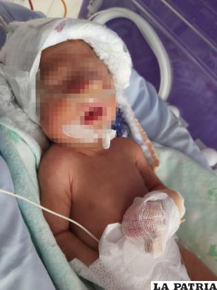Recién nacido terminó con el dedo cercenado /GENTILEZA