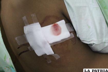 El menor manejaba el vehículo indocumentado cuando fue herido de bala /Cortesía