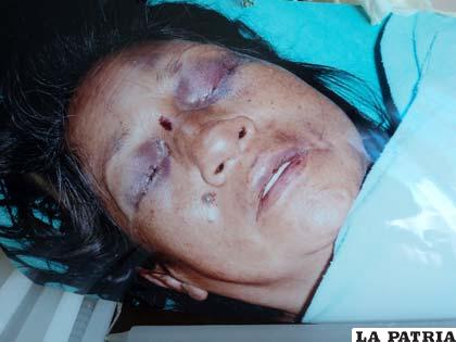 Los golpes fueron evidentes en la humanidad de Teresa