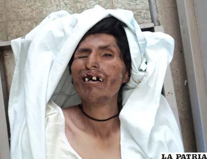 Ronald Peñaranda fue abandonado en la morgue del Hospital General