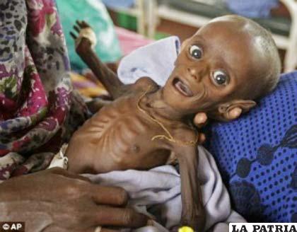 Niño presentado como una víctima más de los refugiados que huyeron por la hambruna en Somalia