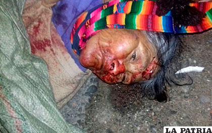 Se desconoce la identidad de la anciana que fue atropellada en la salida a Potosí