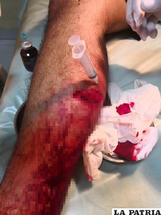 Heridas causadas en la víctima tras el ataque /SEDES