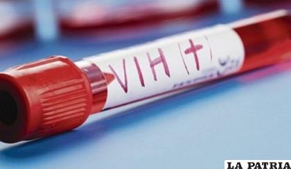 Las personas con VIH/SIDA son un sector vulnerable que debe ser atendido con prioridad /radio.uchile.cl