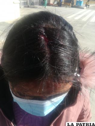 El agresor, golpeó la cabeza de la víctima contra la pared /Cortesía
