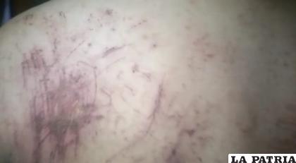 El soldado sufrió varias lesiones en su cuerpo /Cortesía
