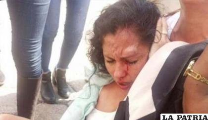La víctima padeció de 15 días de incapacidad tras ser golpeada por varias personas /Fiscalía