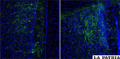 Neuronas CRH+ en la corteza prefrontal de un ratón (izquierda) y axones de dichas neuronas en la región del septum lateral (derecha) /Instituto de Neurociencias EFE