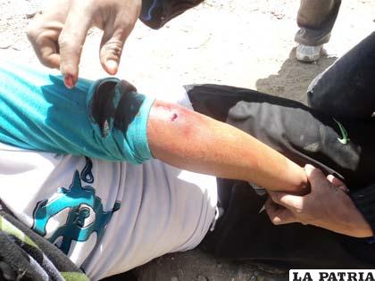 Hubo varios heridos con lesiones en el cuerpo