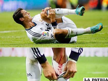 Ronaldo con un corte en la rodilla izquierda (foto: foxsportsla.com)