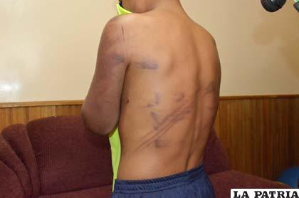 Las heridas son evidentes en la humanidad del muchacho de 14 años