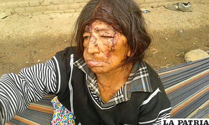 La señora Juana, con la sangre seca en su rostro a consecuencia de la golpiza que le dio su hijo