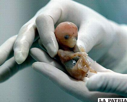 El feto fue extraído sin vida de la adolescente /zetaestaticos.com