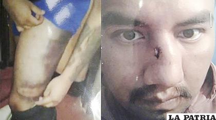 Torturaron a Juan Pari en Chonchocoro / Los Tiempos
