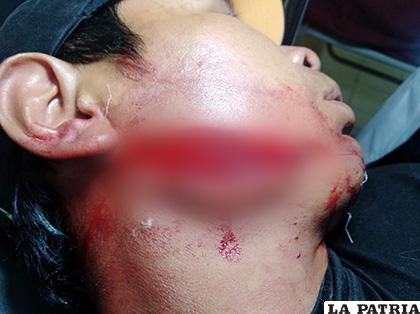 La víctima presenta una herida de aproximadamente 10 centímetros en el rostro /LA PATRIA