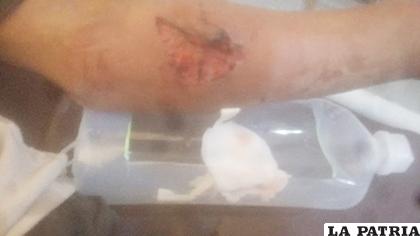 Herida en el brazo de la víctima provocada por el can fue profunda /LA PATRIA