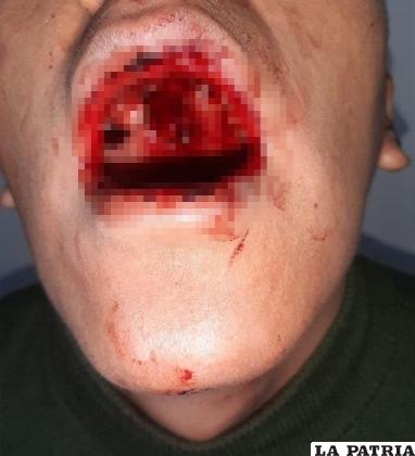 El efectivo policial salió herido tras ser baleado por el reo /Archivo LA PATRIA