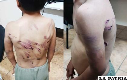 Las marcas evidencian la violencia que sufrió por su padre / Urgente.bo