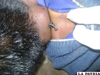 Los delincuentes tuvieron que utilizar un alicate para asegurar el alambre