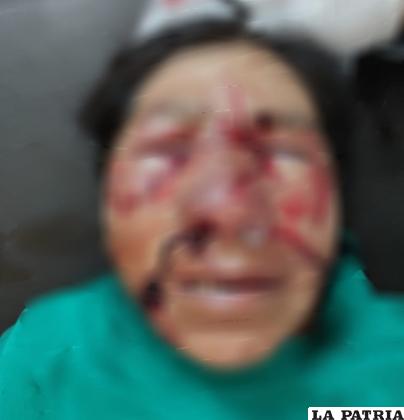 Mujer fue atacada por cuatro perros en la cara /SEDES
