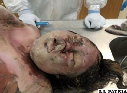 Hace poco la Felcv publicó el rostro de la víctima para que sea identificada /FELCV