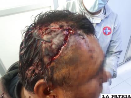 El herido se produjo una lesión sensible en su cabeza /LA PATRIA