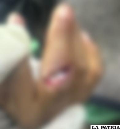 Niño fue mordido por un mono /SEDES
