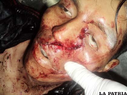 El muchacho tenía otra herida en el rostro