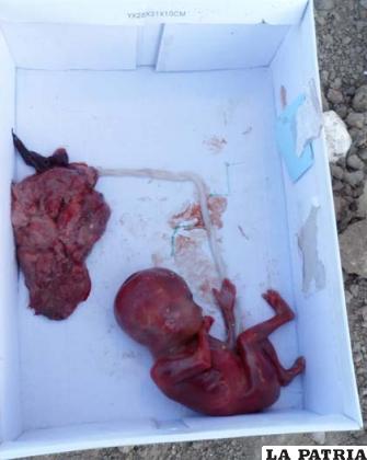 El cuerpo del feto en la caja de zapatos