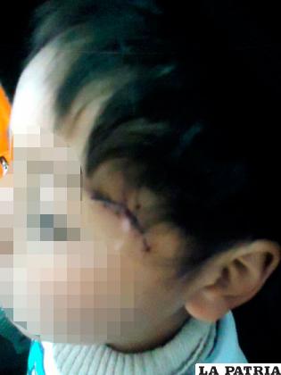 La herida que quedó como evidencia de la agresión sufrida por el niño