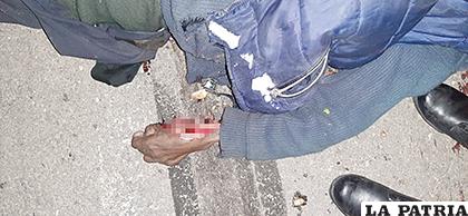 La Policía investiga las causas de lo ocurrido /LA PATRIA
