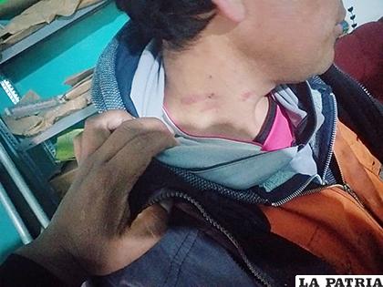 Las marcas en el cuello de la víctima /LA PATRIA
