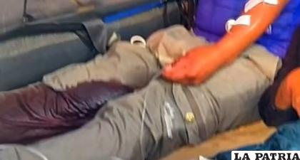 Uno de los sujetos fue herido de bala en su pierna /LA PATRIA