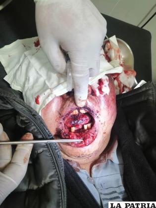Sujeto salió gravemente herido tras ser golpeado por su hijo
