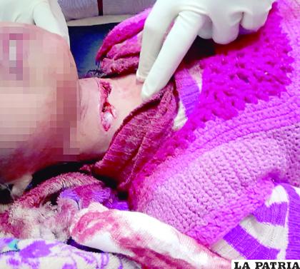 Dos infantes estuvieron a punto de morir luego de ser degolladas por su madre