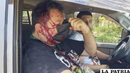 Periodista del diario El Deber, Juan Carlos Fortún agredido 
/Cortesía
