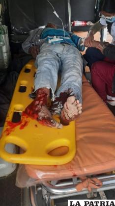La víctima padece de una grave lesión en la pierna derecha /Cortesía
